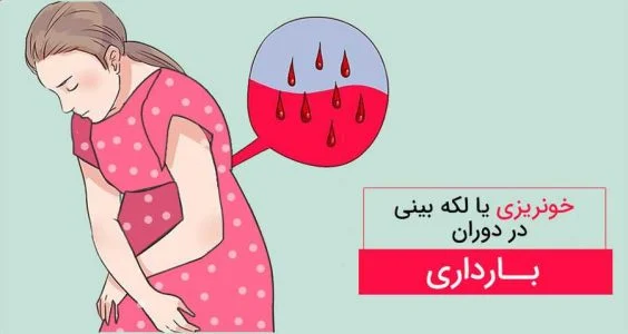 تفاوت بین لکه بینی و خونریزی در بارداری چیست؟