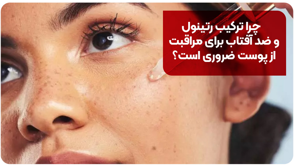 چرا ترکیب رتینول و ضد آفتاب برای مراقبت از پوست ضروری است؟