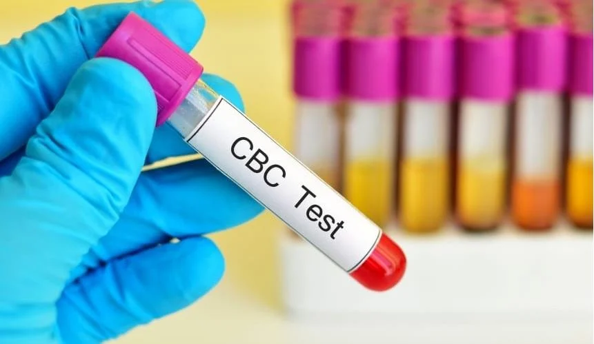 آزمایش خون CBC - رنج نرمال آنها